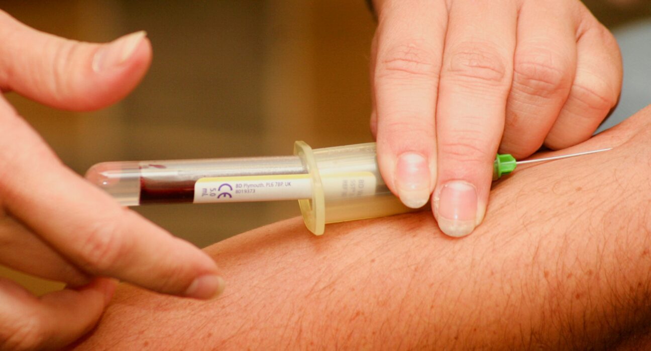 Engleska uvodi test krvi za dijagnostifikovanje raka 2