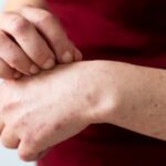 Autoimuna bolest štitne žlezde: sve što treba da znate o Hashimotu