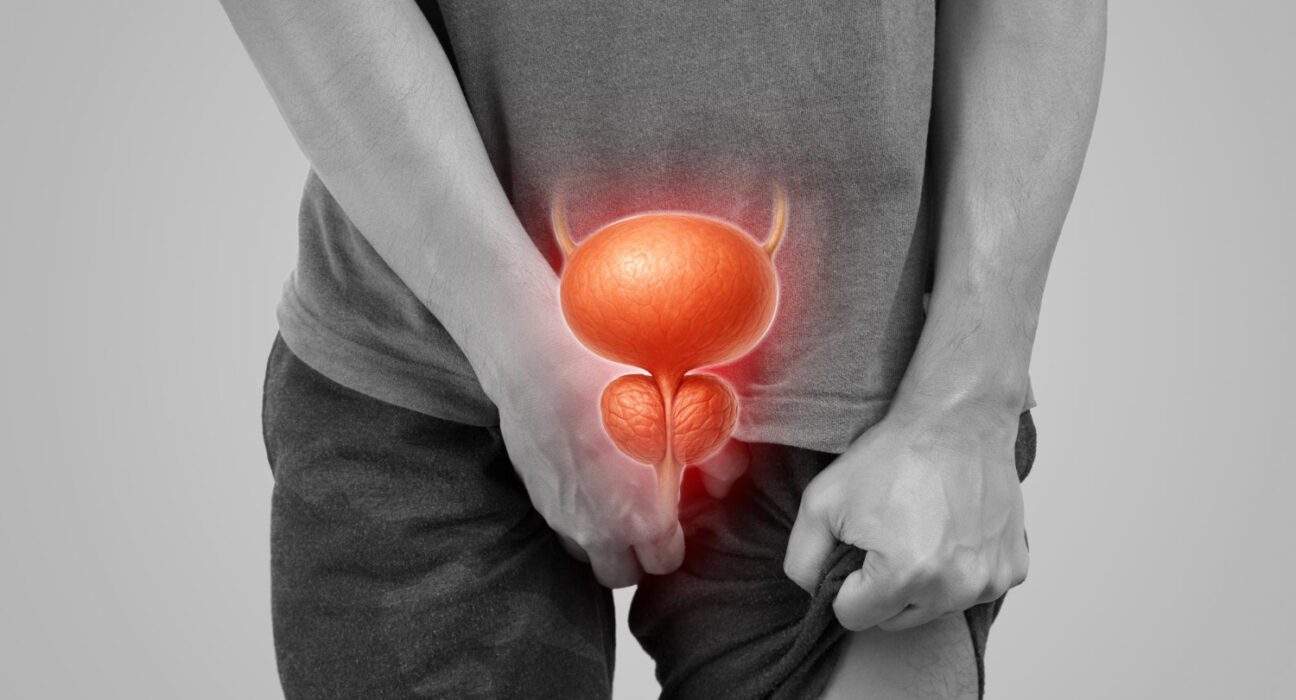 Problemi sa prostatom kod muskaraca