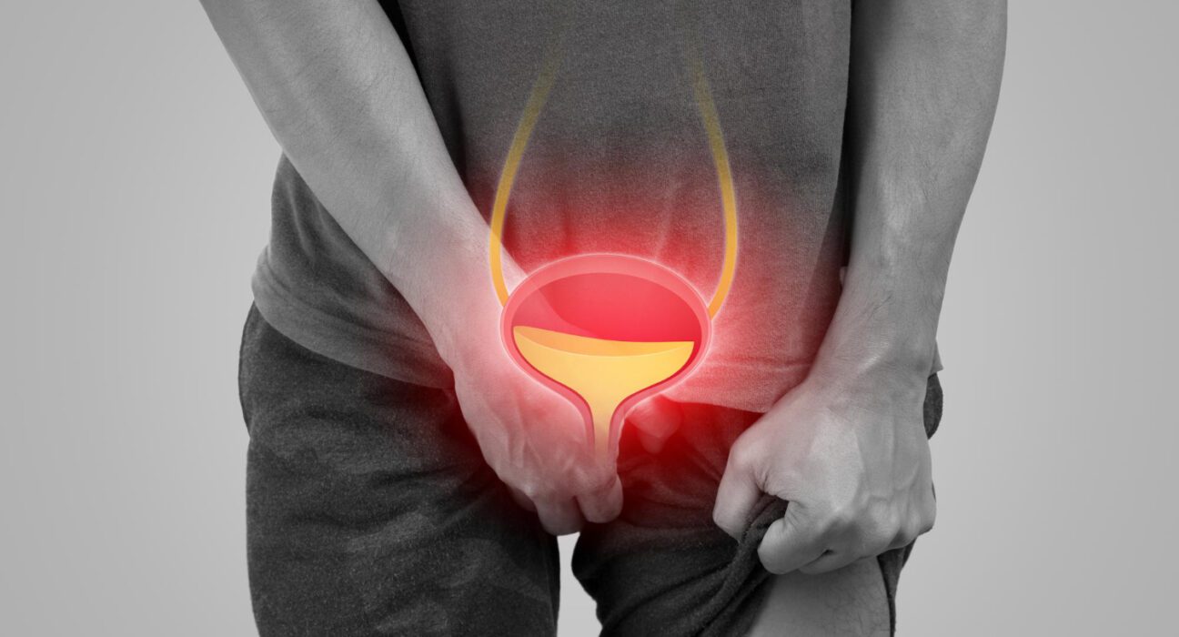 ejakulacijom protiv raka prostate